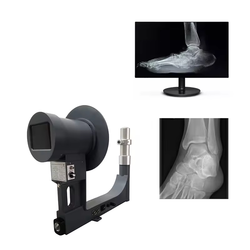 Portable X-ray Fluoroscopy System